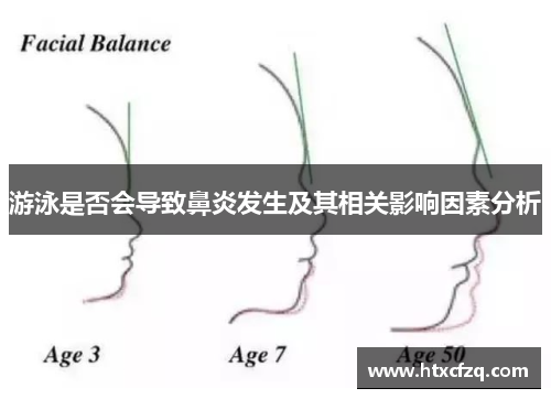 游泳是否会导致鼻炎发生及其相关影响因素分析